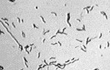 Campylobacter jejuni, Campylobacter coli, C.Coli, кампилобактер, кампилобактериоз, бактерии, кампилобактерный энтерит, гастроэнтерит, вода, патогенные водные микроорганизмы.